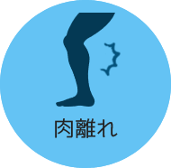 肉離れイメージ